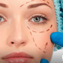 Cirugia estetica facial